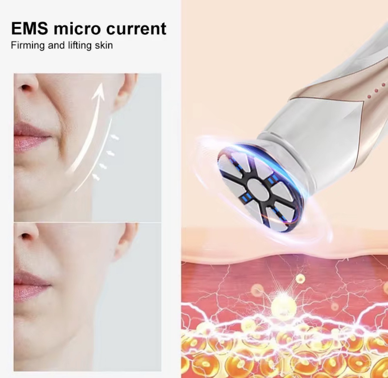 RF & EMS Skin Renewal Device - Image 6